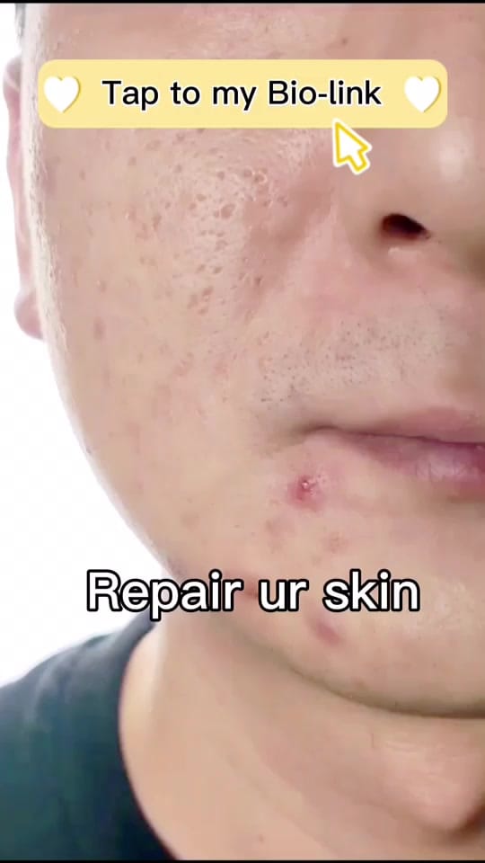 Post 10 by beautyhack on TikTok (video)