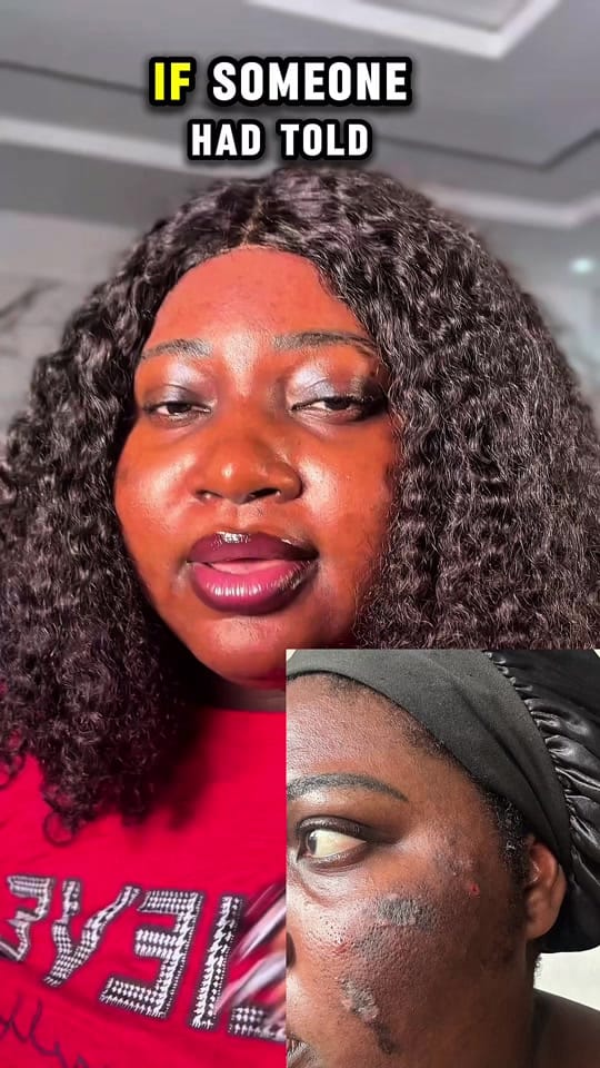 Post 3 by Korean Skincare by Duchess on TikTok (video)