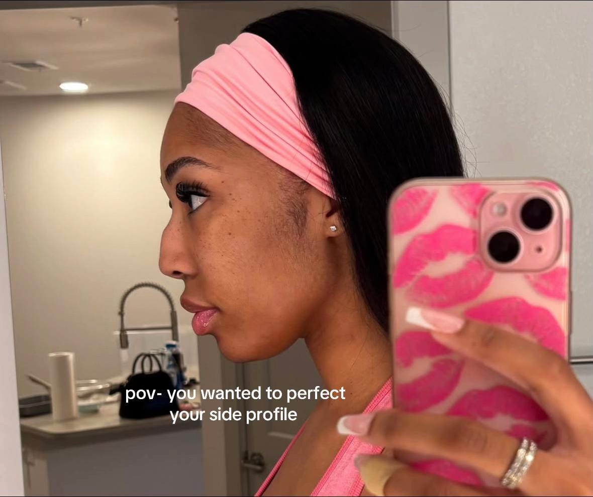 Post 7 by Facial Balancing Specialist💉 on TikTok (video)