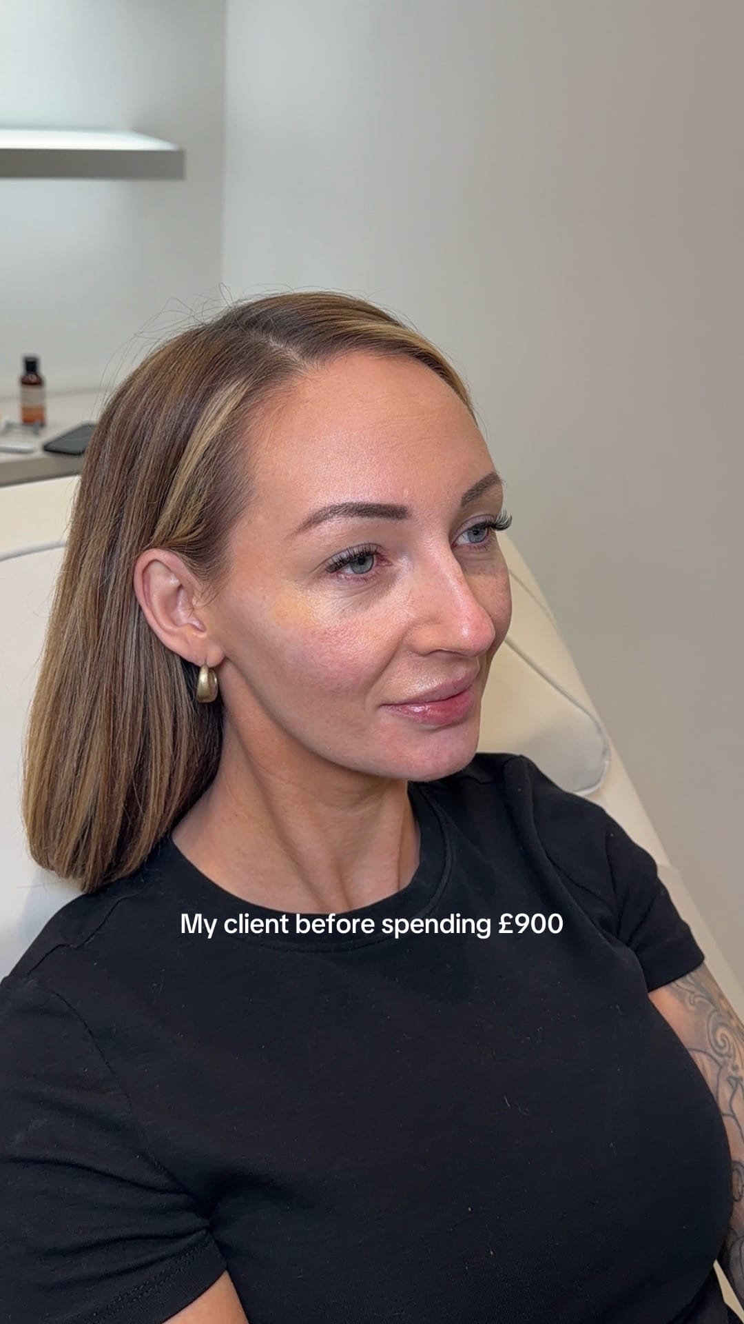 Post 6 by Facial Balancing Specialist💉 on TikTok (video)