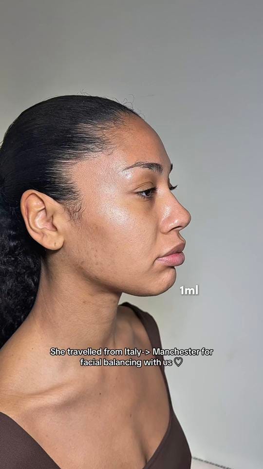 Post 1 by Facial Balancing Specialist💉 on TikTok (video)