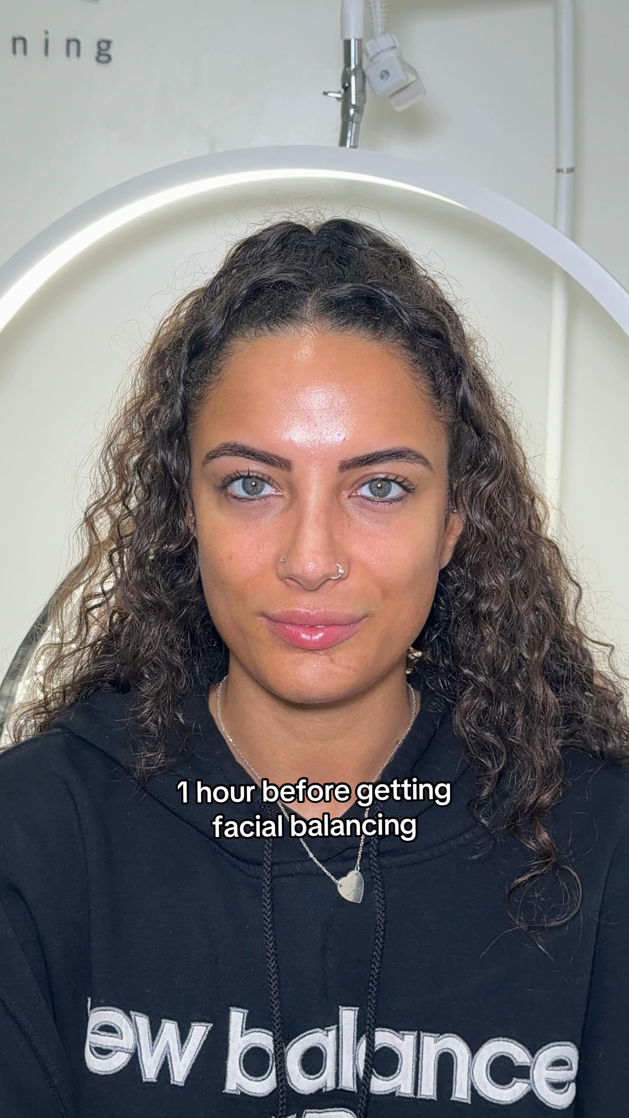 Post 2 by Facial Balancing Specialist💉 on TikTok (video)