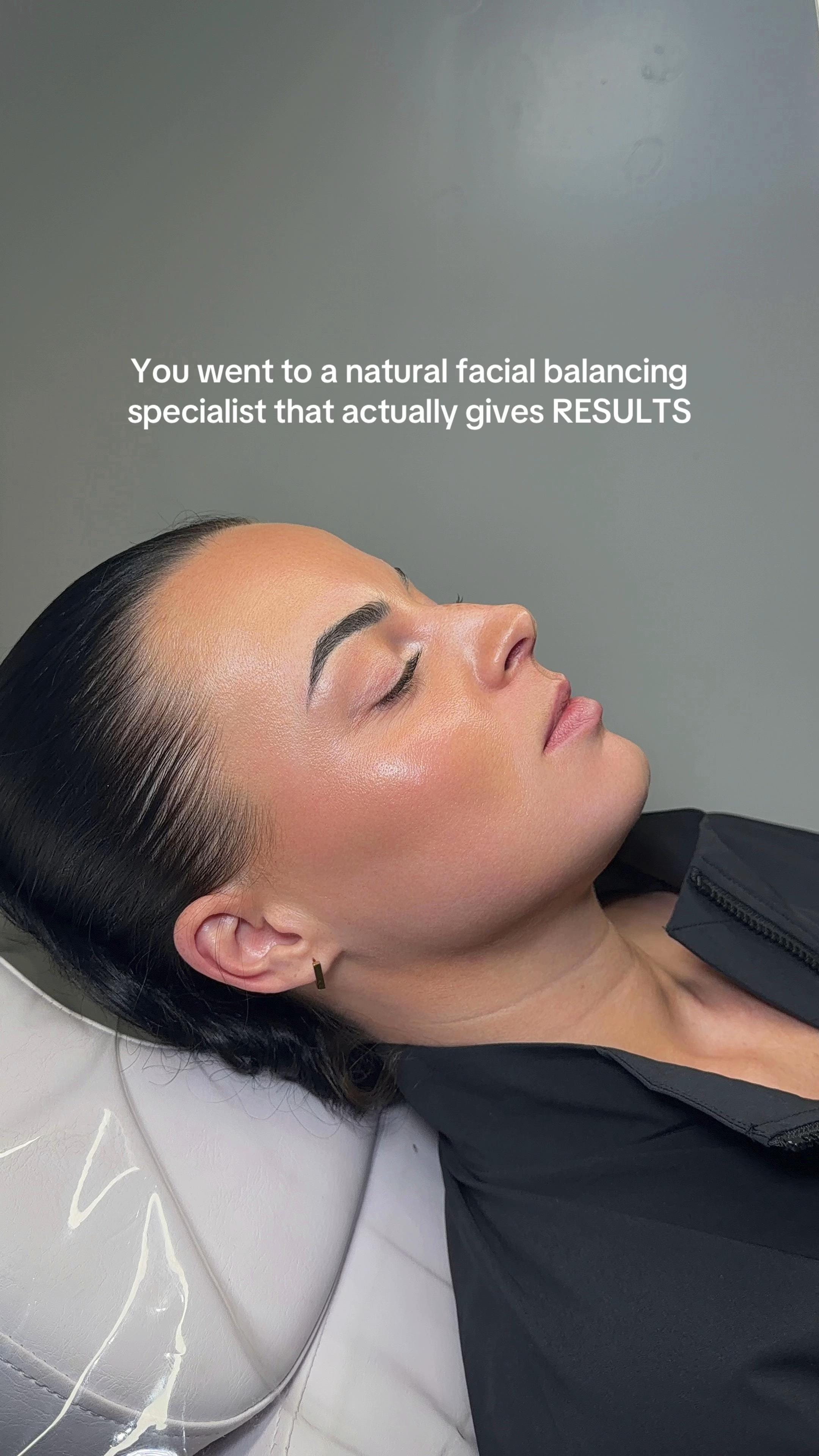 Post 4 by Facial Balancing Specialist💉 on TikTok (video)