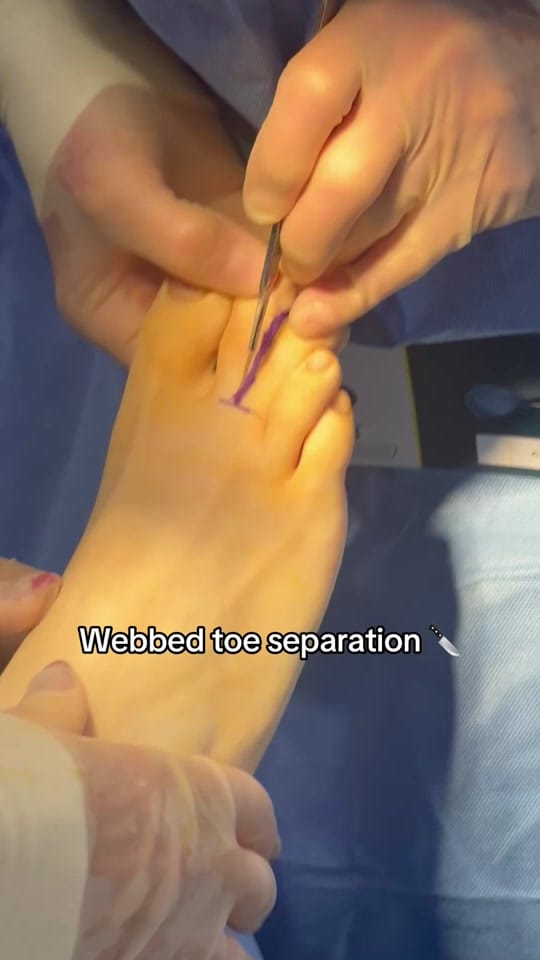 Post 10 by Foot & Ankle Centre on TikTok (video)