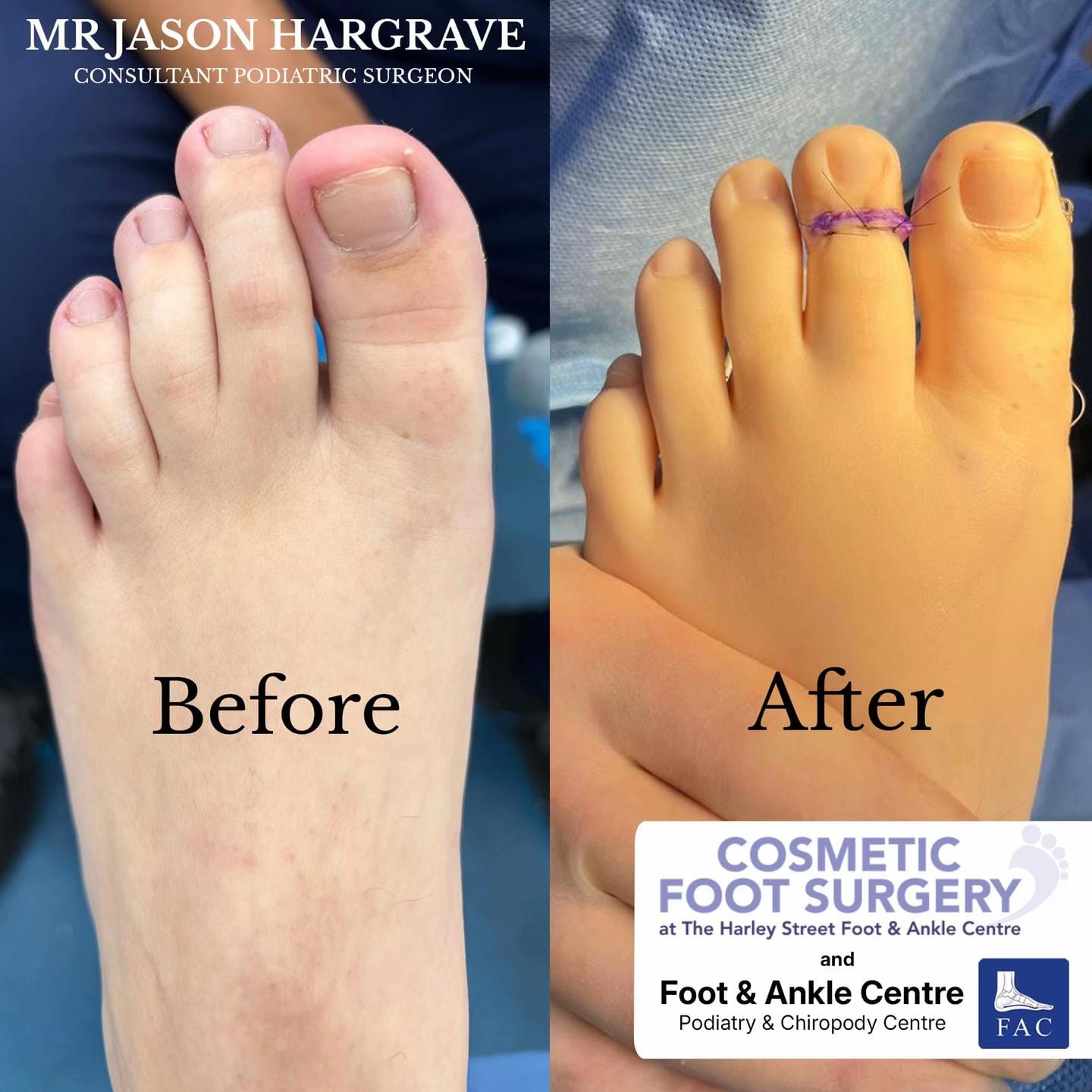 Post 8 by Foot & Ankle Centre on TikTok (video)