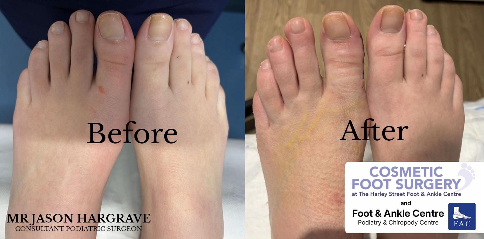 Post 7 by Foot & Ankle Centre on TikTok (video)