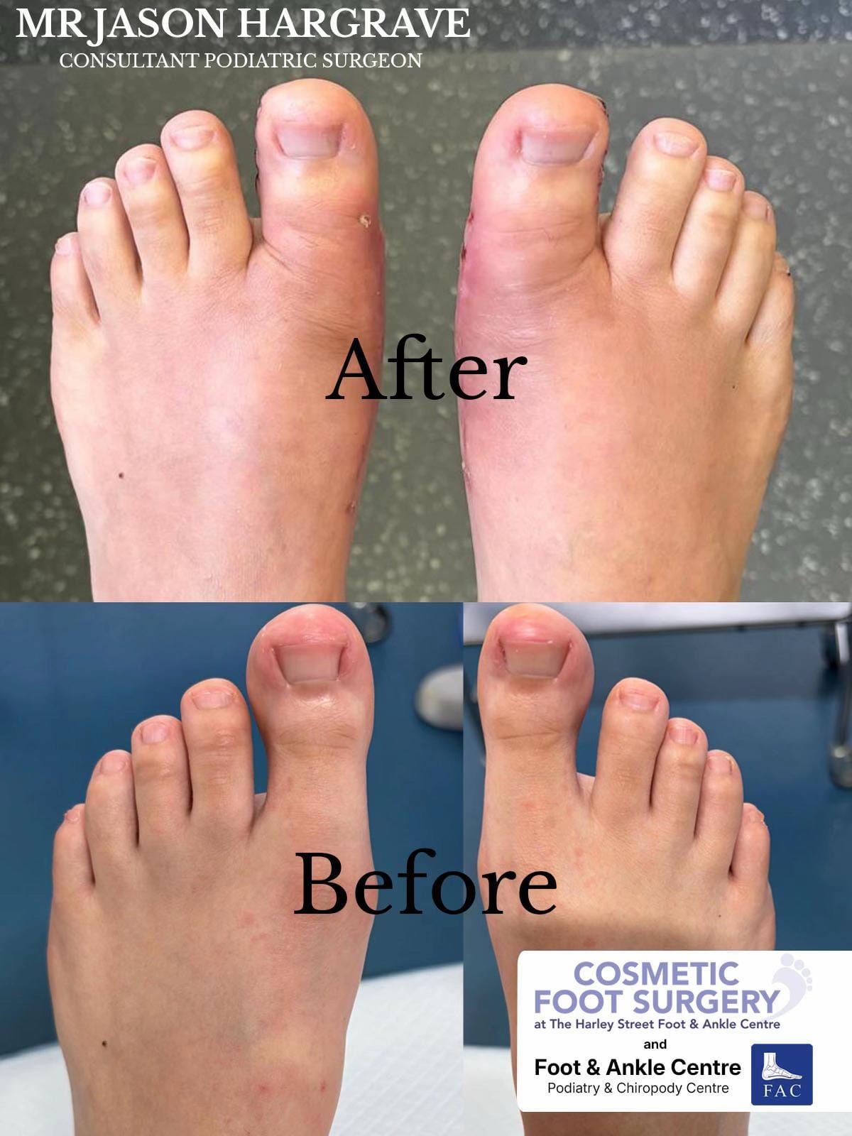 Post 5 by Foot & Ankle Centre on TikTok (video)