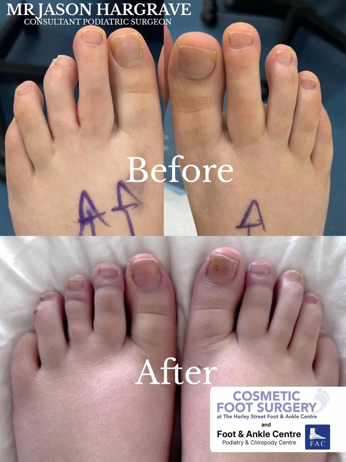 Post 3 by Foot & Ankle Centre on TikTok (video)