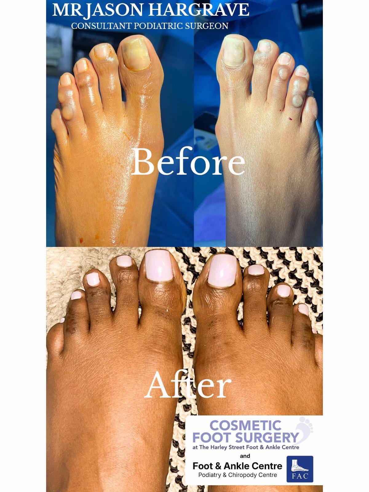 Post 4 by Foot & Ankle Centre on TikTok (video)