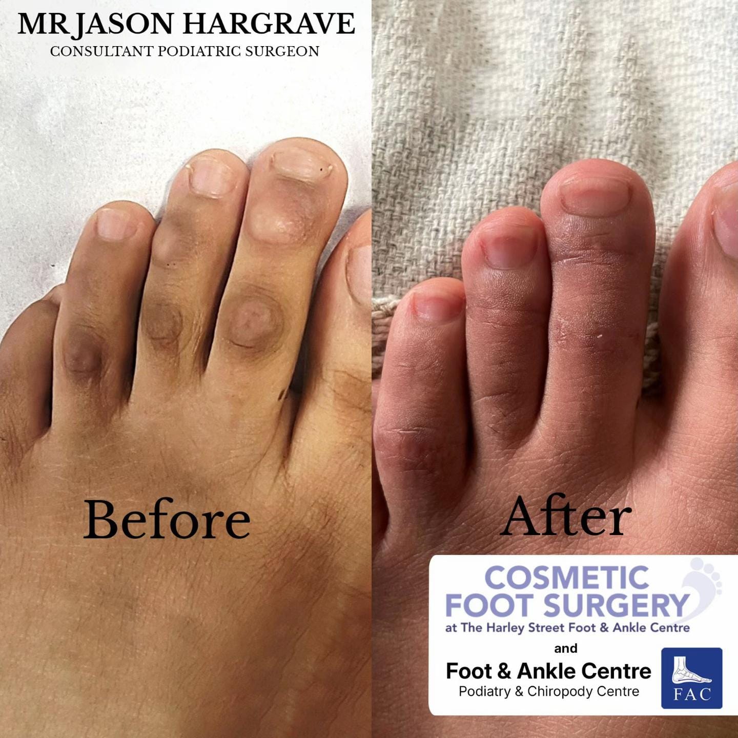 Post 2 by Foot & Ankle Centre on TikTok (video)