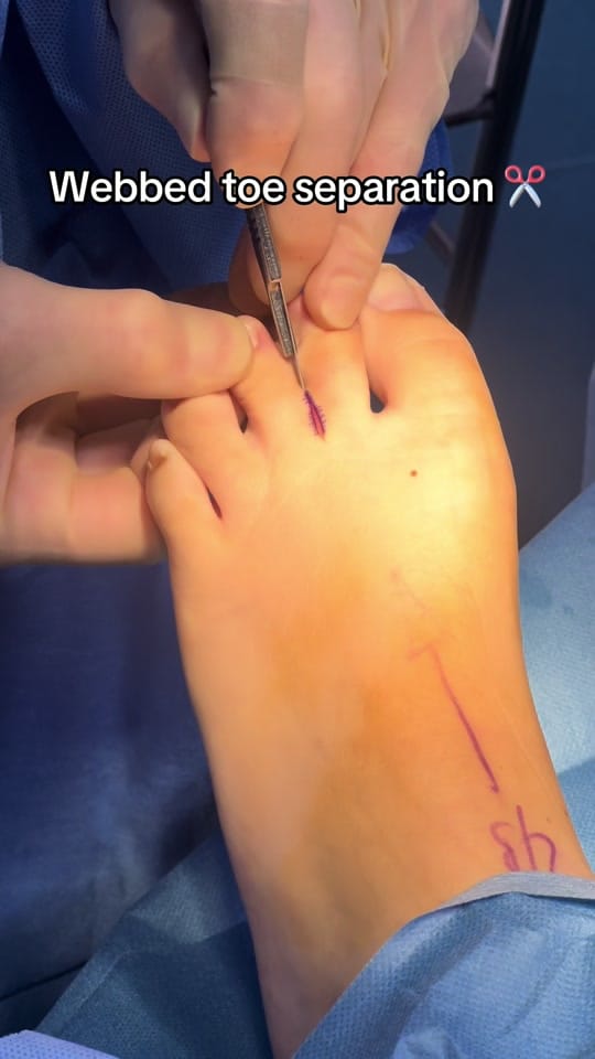 Post 9 by Foot & Ankle Centre on TikTok (video)
