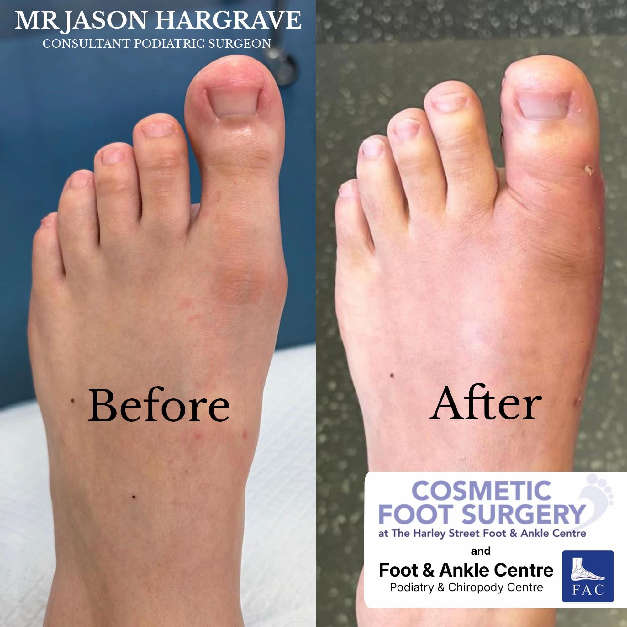Post 6 by Foot & Ankle Centre on TikTok (video)
