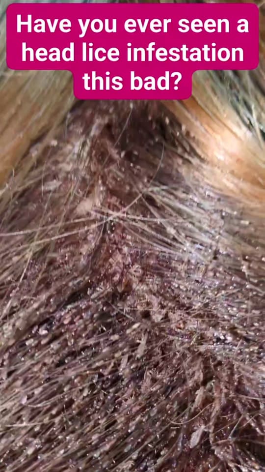 Post 4 by Nit Nurse on TikTok (video)