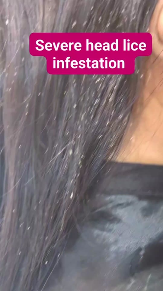 Post 1 by Nit Nurse on TikTok (video)