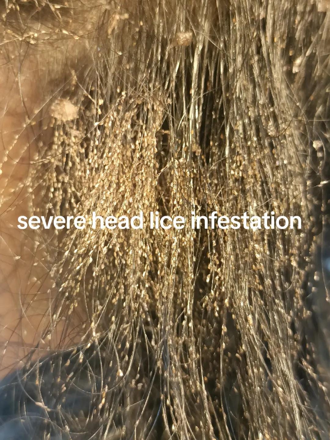 Post 10 by Nit Nurse on TikTok (video)