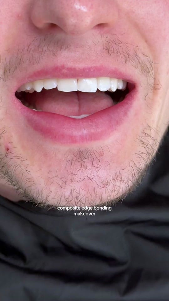 Post 5 by Maison Dental on TikTok (video)