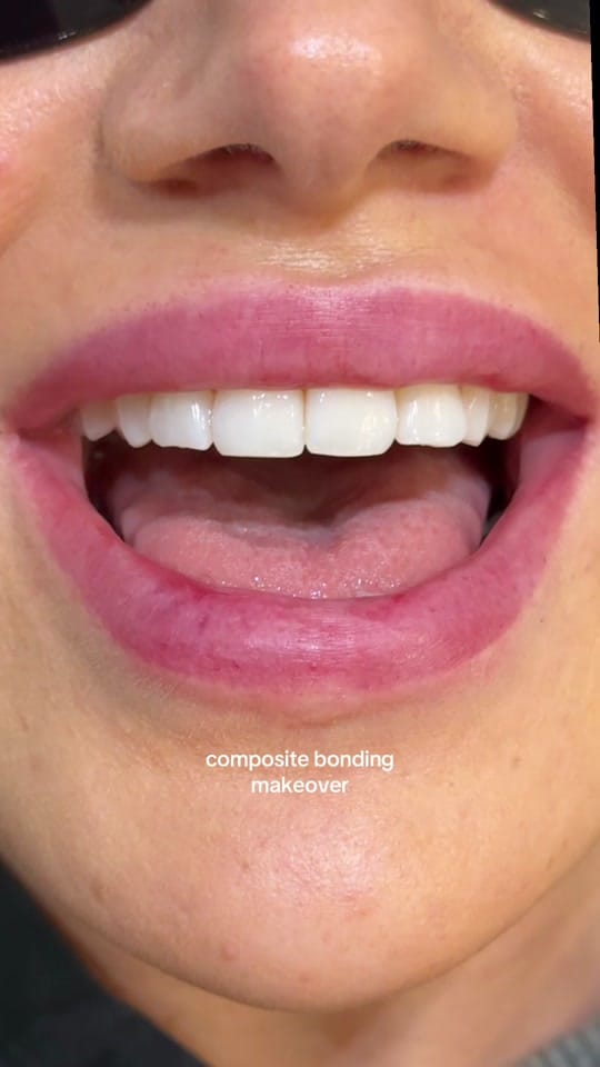 Post 1 by Maison Dental on TikTok (video)
