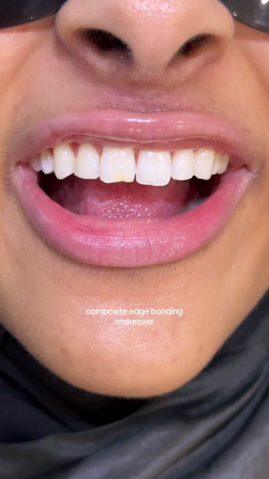 Post 2 by Maison Dental on TikTok (video)