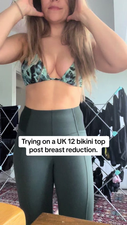 Post 9 by breastreductionjourney on TikTok (video)