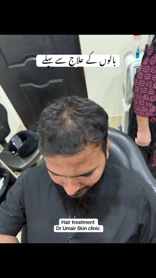 Post 6 by Dr Umair Irfan Skin Doctor on TikTok (video)