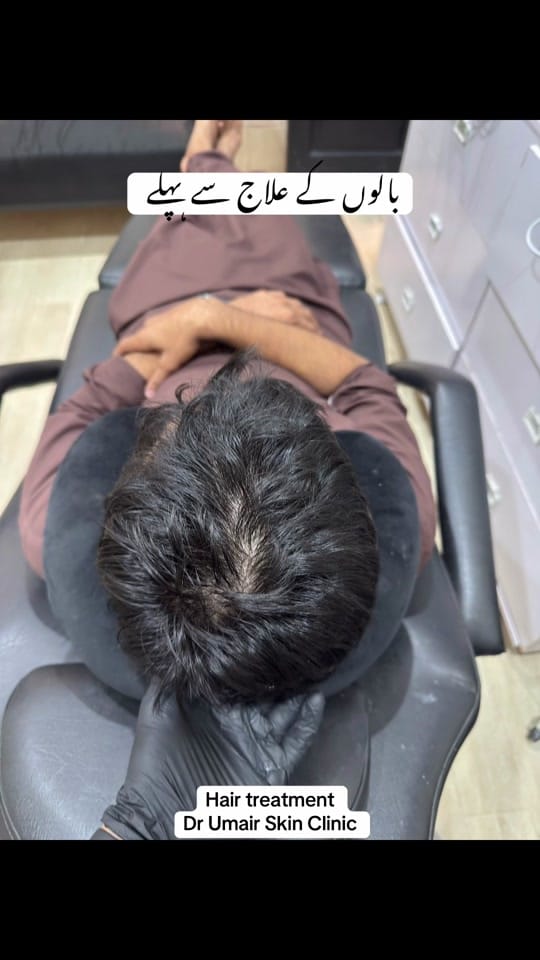 Post 2 by Dr Umair Irfan Skin Doctor on TikTok (video)