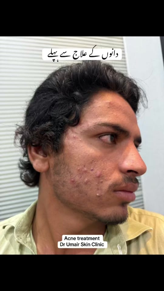 Post 10 by Dr Umair Irfan Skin Doctor on TikTok (video)