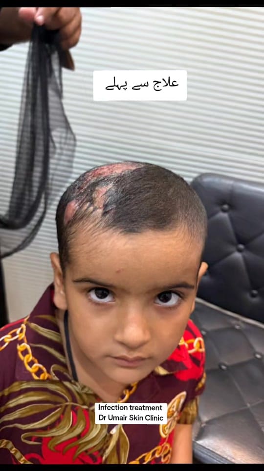 Post 8 by Dr Umair Irfan Skin Doctor on TikTok (video)