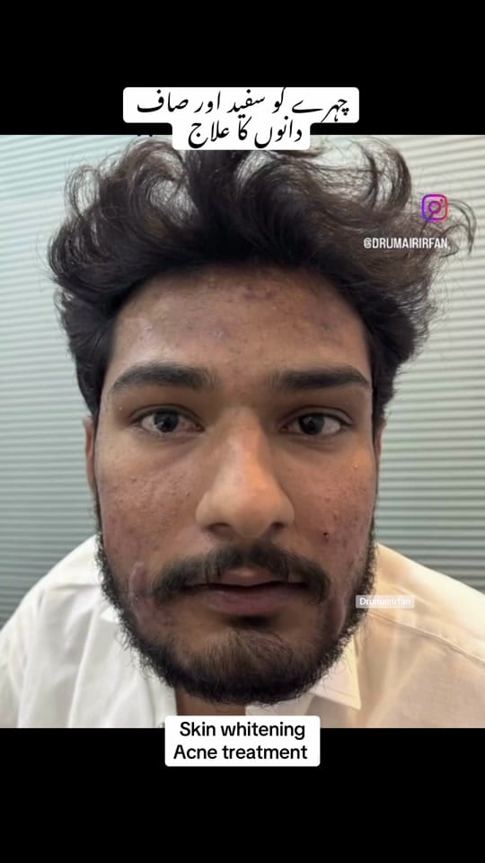 Post 4 by Dr Umair Irfan Skin Doctor on TikTok (video)