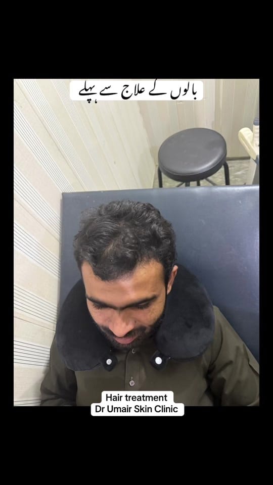 Post 5 by Dr Umair Irfan Skin Doctor on TikTok (video)