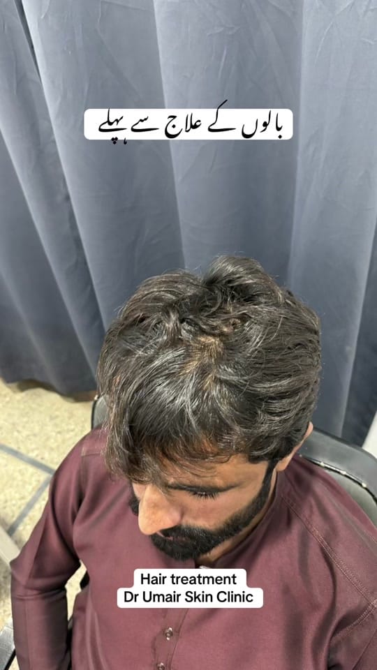 Post 9 by Dr Umair Irfan Skin Doctor on TikTok (video)
