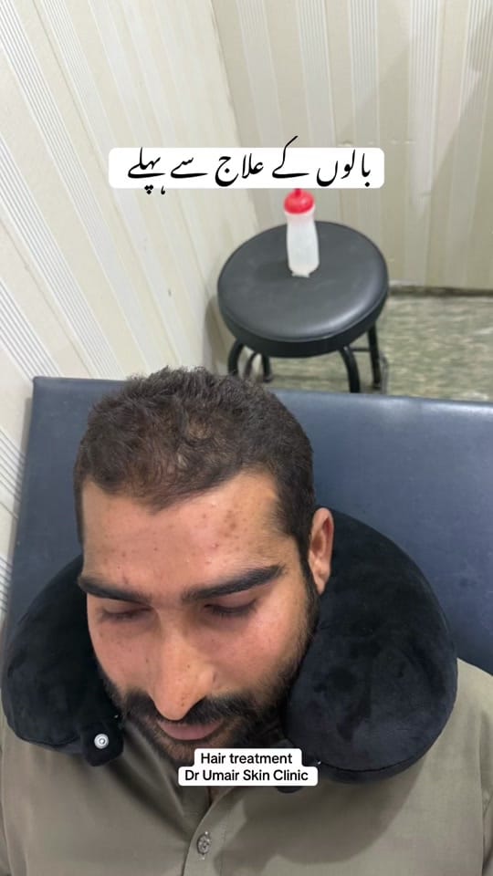 Post 7 by Dr Umair Irfan Skin Doctor on TikTok (video)