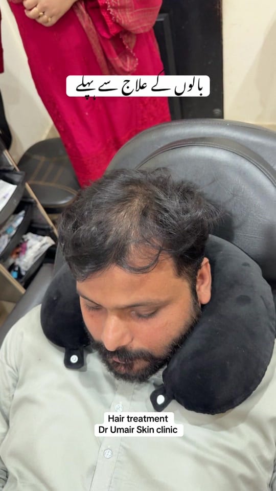 Post 3 by Dr Umair Irfan Skin Doctor on TikTok (video)