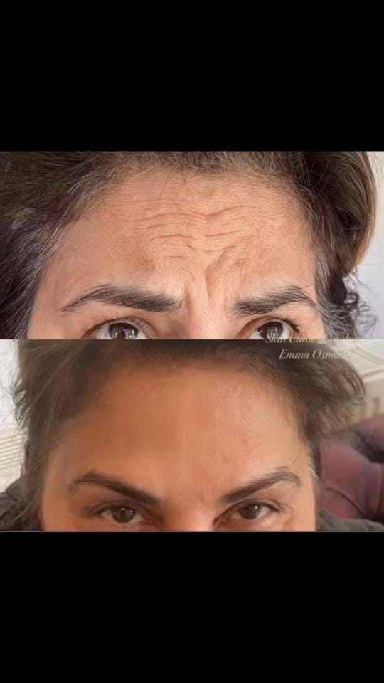 Post 5 by Skin Clinics London Emma Osman on TikTok (video)