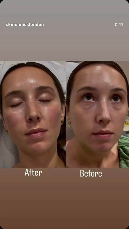 Post 4 by Skin Clinics London Emma Osman on TikTok (video)