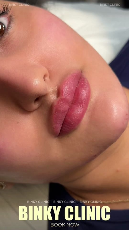 Post 8 by BINKY on TikTok (video)
