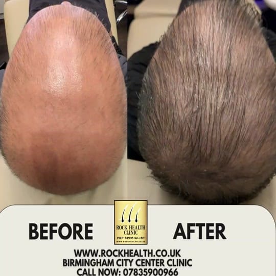 Post 8 by www.rockhealth.co.uk on TikTok (video)