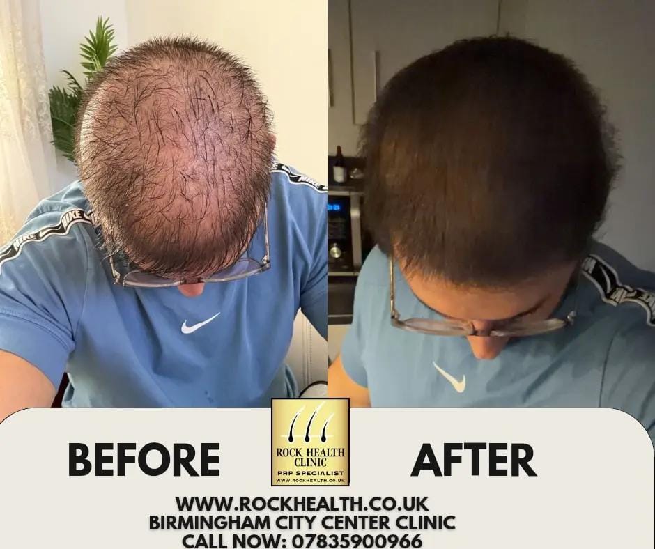 Post 9 by www.rockhealth.co.uk on TikTok (video)