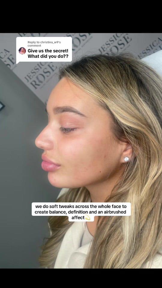 Post 7 by Jessica Rose Aesthetics 💘 on TikTok (video)