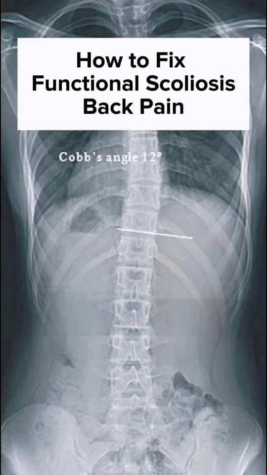 Post 4 by Osteopath | Health Advocate ⚕️ on TikTok (video)