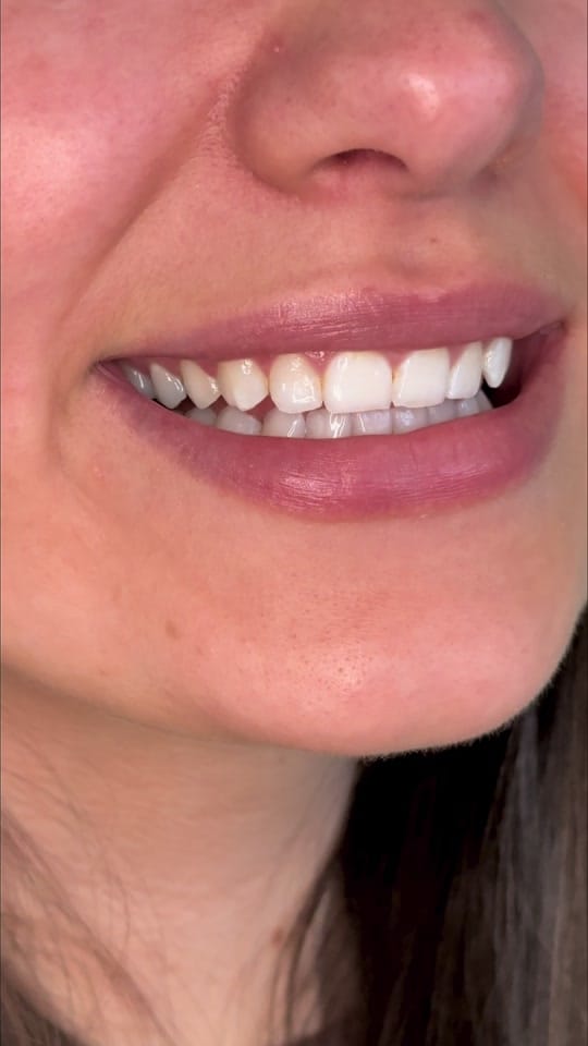 Post 5 by Martina Collins Dental Clinic on TikTok (video)