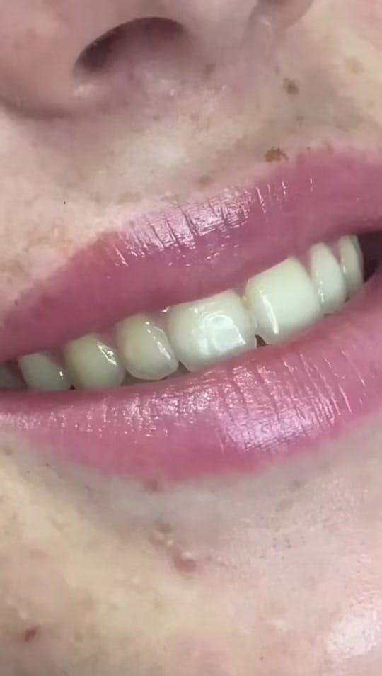 Post 10 by Martina Collins Dental Clinic on TikTok (video)