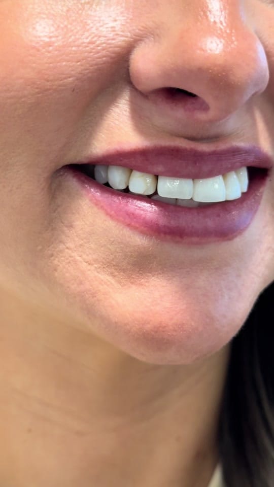 Post 7 by Martina Collins Dental Clinic on TikTok (video)