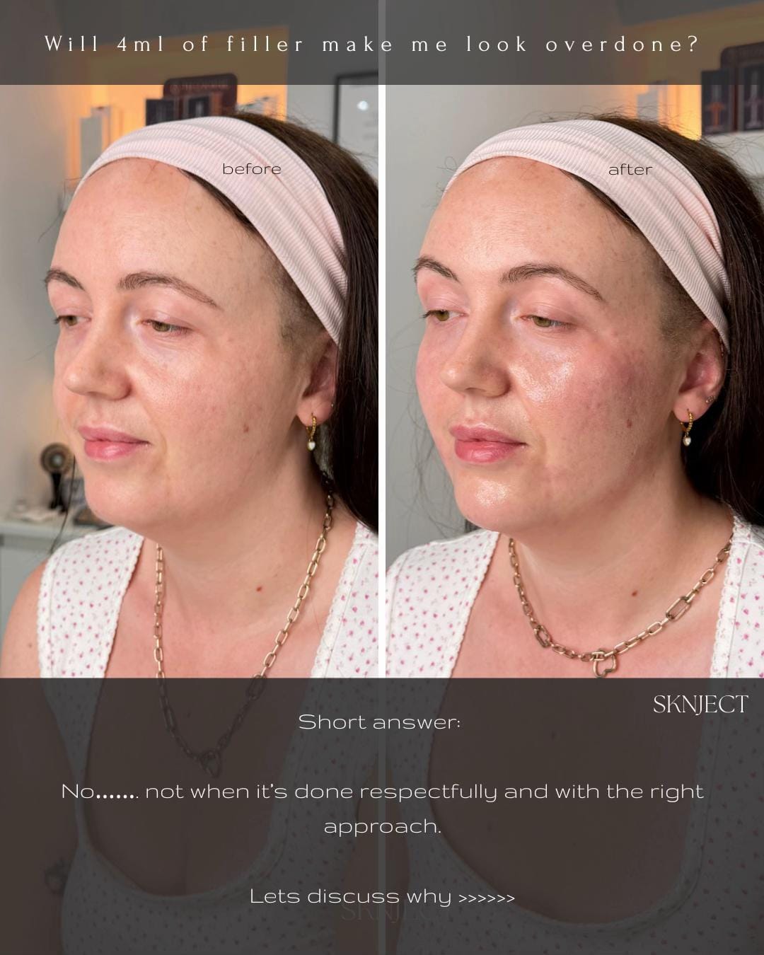 Post 2 by sknject on TikTok (video)