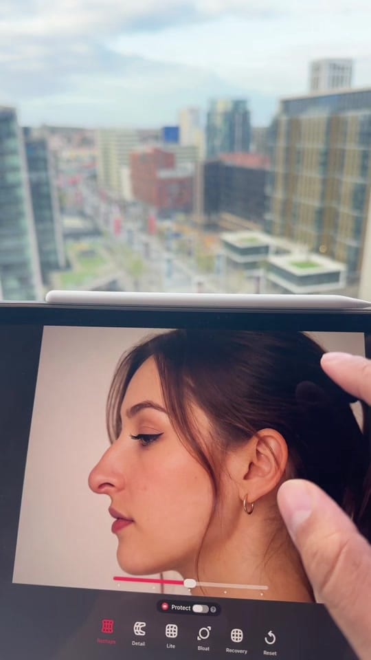 Post 7 by Dr.Zuwayed | د.عبدالله الزويد on TikTok (video)