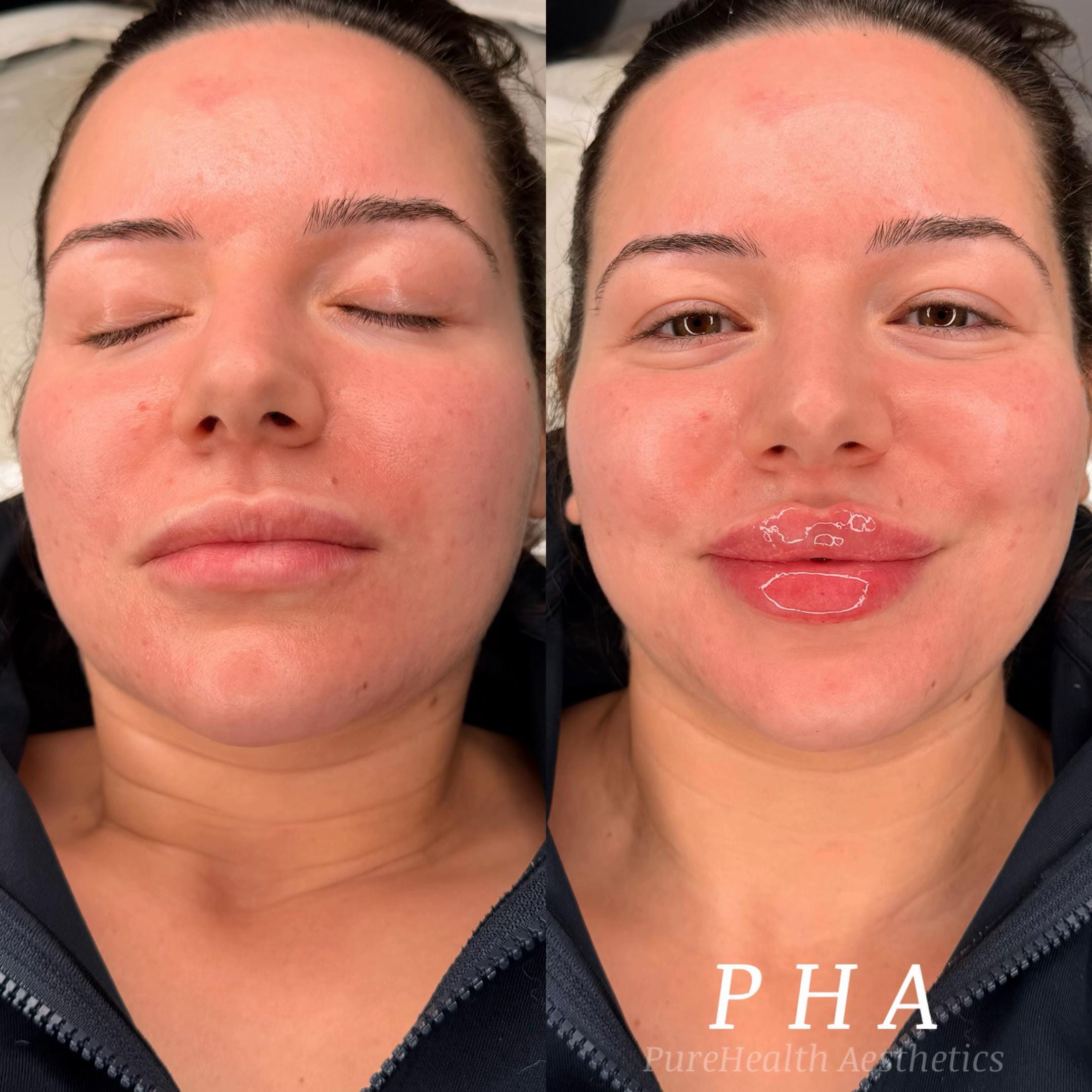 Post 5 by PureHealthAesthetics on TikTok (video)