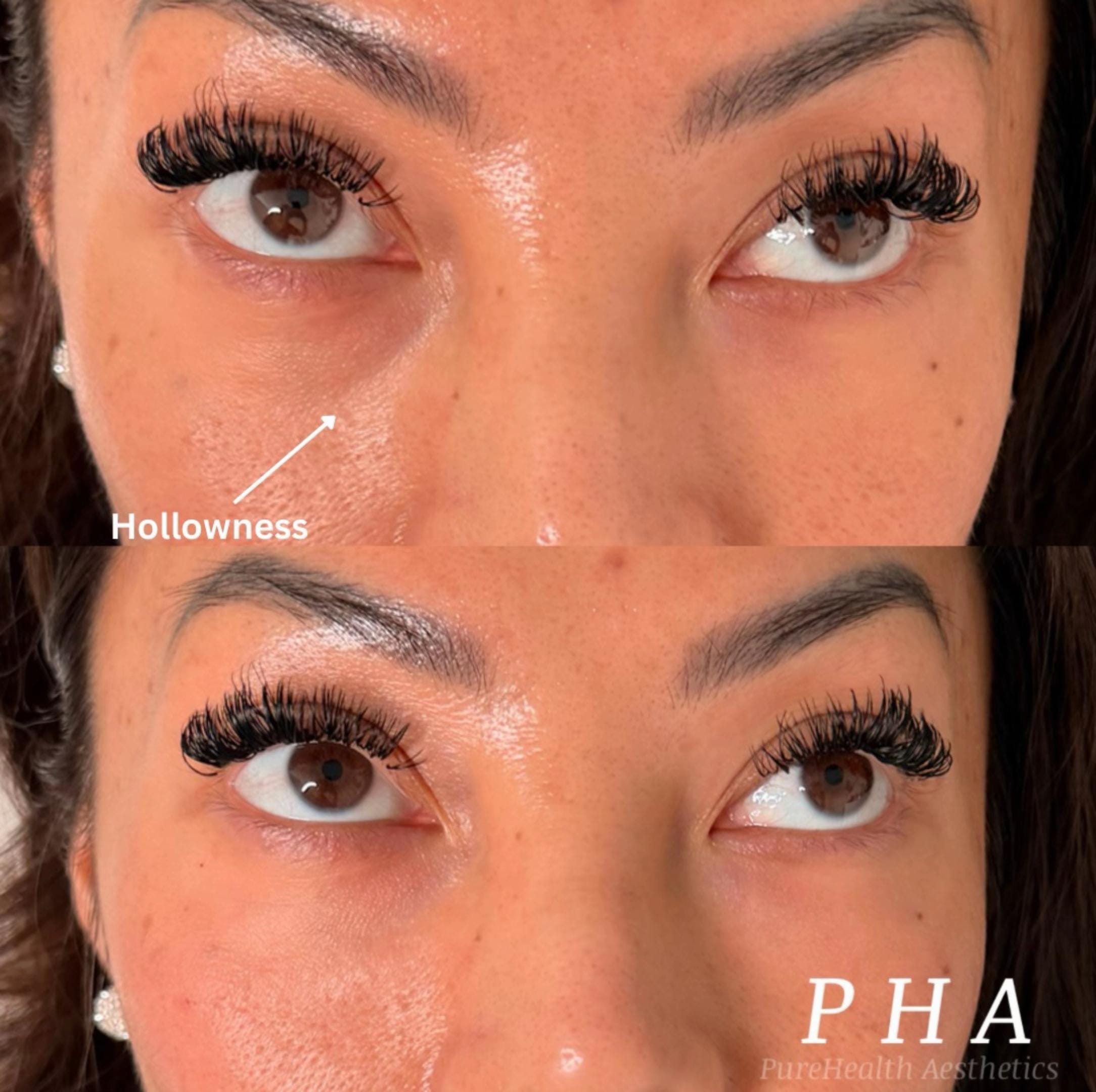 Post 6 by PureHealthAesthetics on TikTok (video)