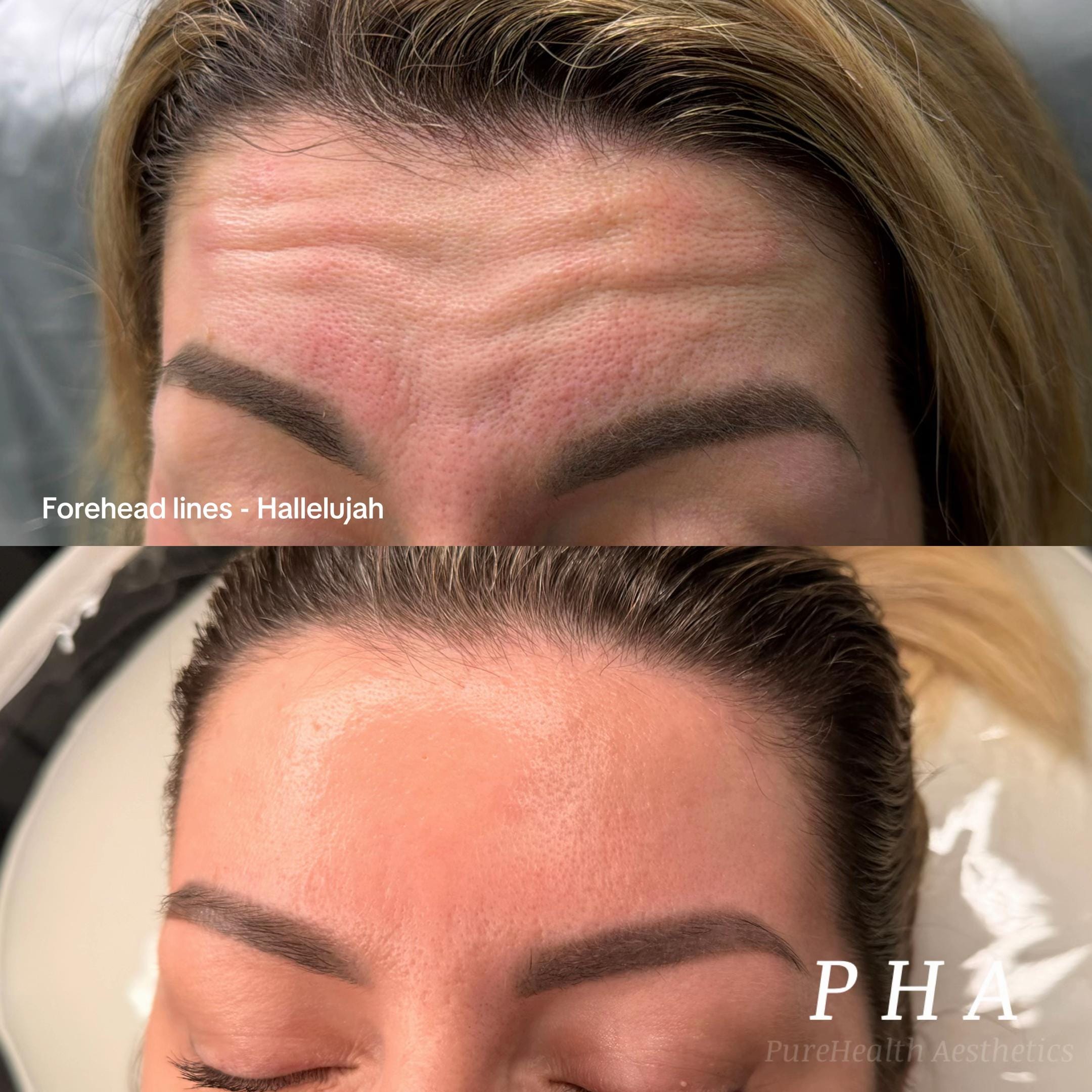 Post 9 by PureHealthAesthetics on TikTok (video)