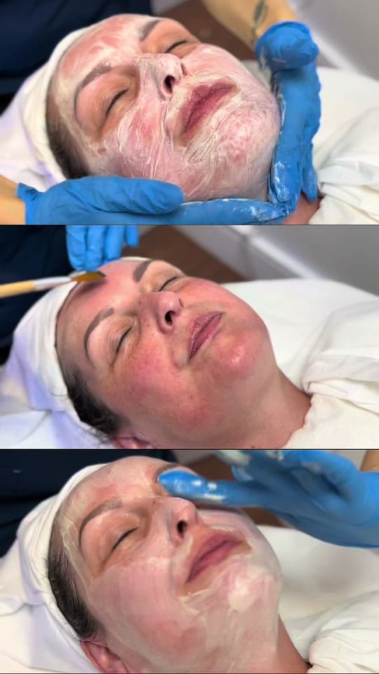 Post 9 by Skin & Laser Experts on TikTok (video)