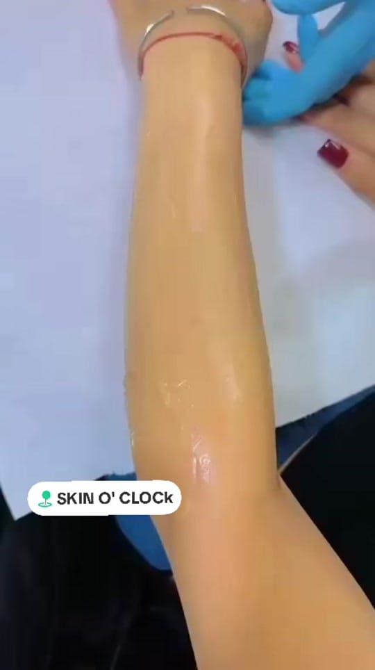 Post 2 by skinoclockuk on TikTok (video)