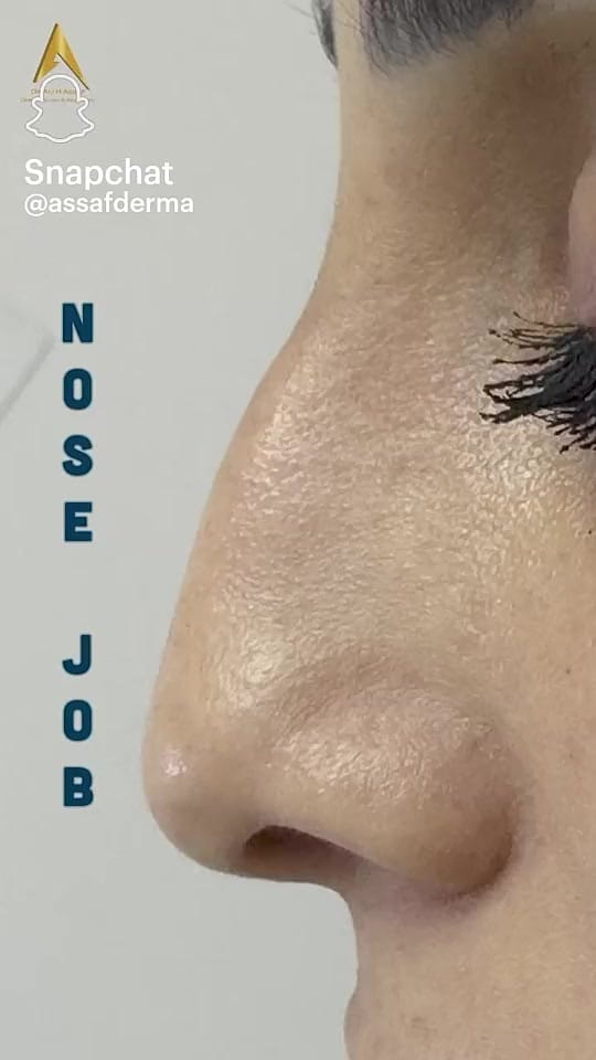 Post 4 by Dr. Ali Hamzah Assaf on TikTok (video)